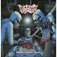 Pulmonary Fibrosis Idiopathic Pulmonary Fibrosis